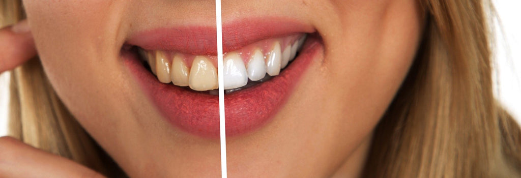 Dentistry in Compounding/Dental Compounding Treatments by Custom Health RX – A personalized medicine and organic pharmacy in Canton, Michigan (MI)